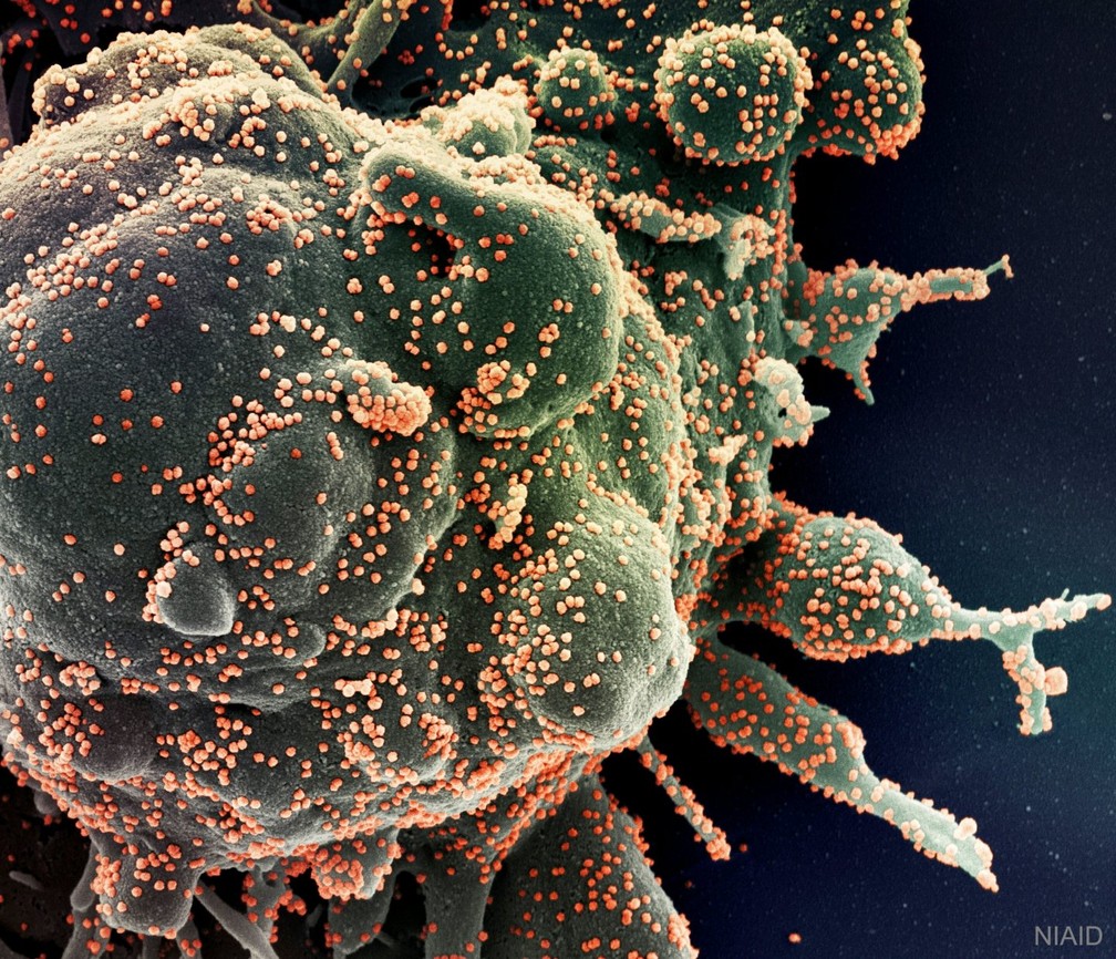 Anticorpos de pacientes que tiveram Covid ficaram mais potentes 6 meses após infecção, diz estudo liderado por brasileiros na 'Nature'